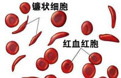 人體茄子视频破解版廠家介紹檢測微量元素的儀器 人體茄子视频破解版廠家介紹檢測微量元素的儀器